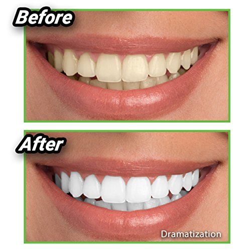 ONTEL Miracle Teeth Whitener